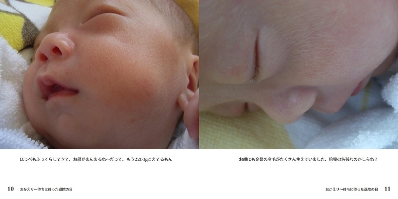 Hisanyo Hotmail Comの作品 おかえり 待ちに待った退院の日 フォトブック フォト 写真 アルバム作成ならphotoback