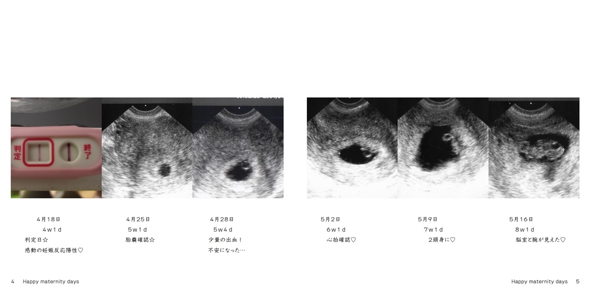 ハッピークローバーの作品 Happy Maternity Days フォトブック フォト 写真 アルバム作成ならphotoback